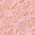 Muted Pink and Tan Tiger Stripe & Leopard Spot Abstract Animal Print Image